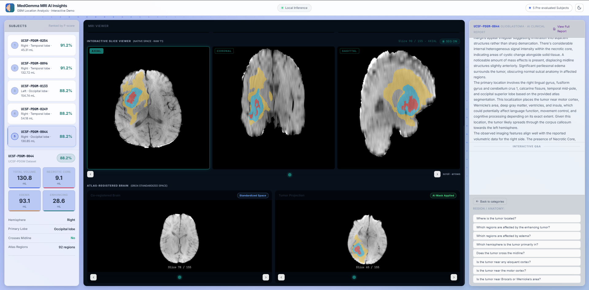 Dashboard Native MRI Viewer and Chat